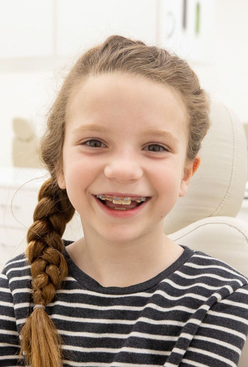 Razi Orthodontics child braces patient