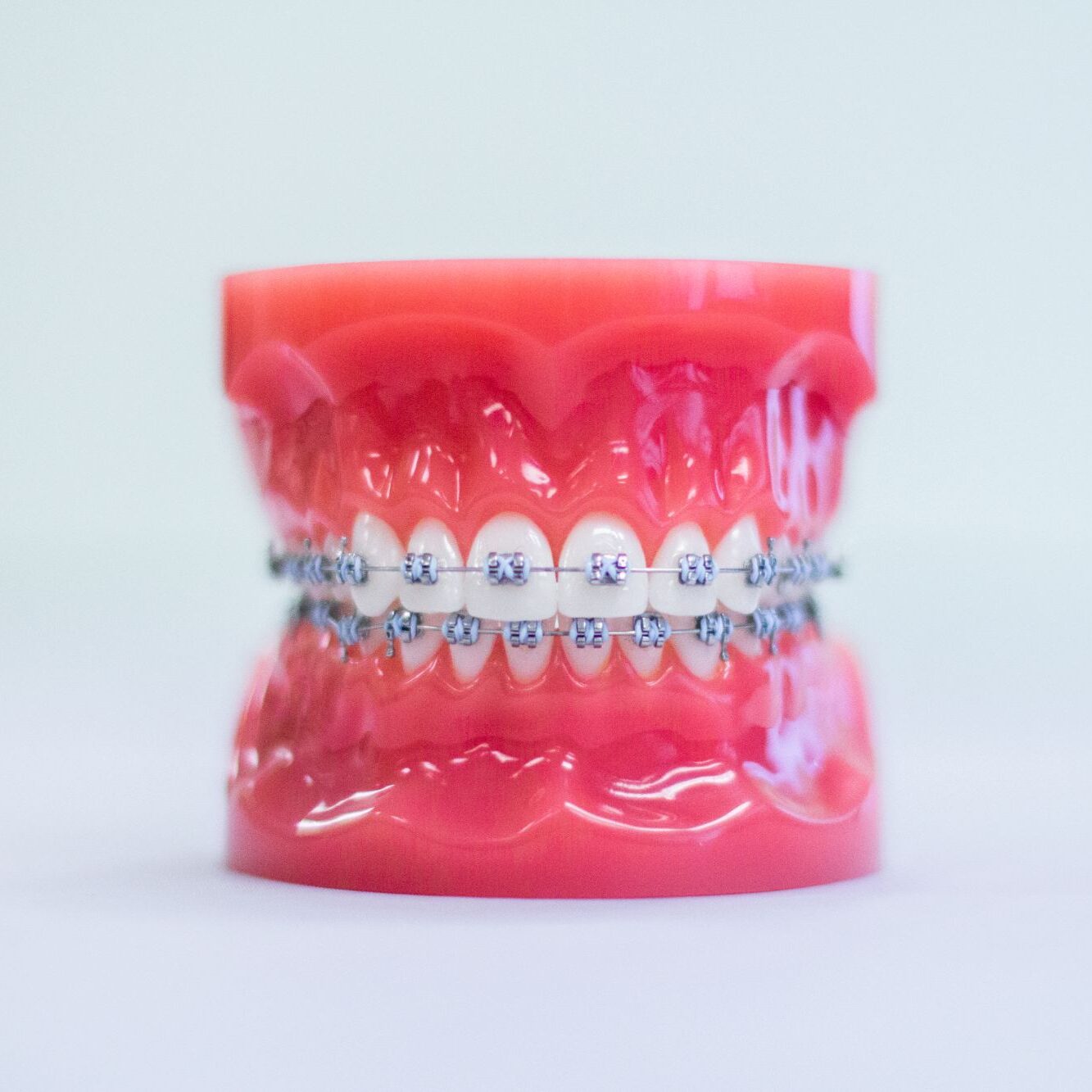 wheaton braces