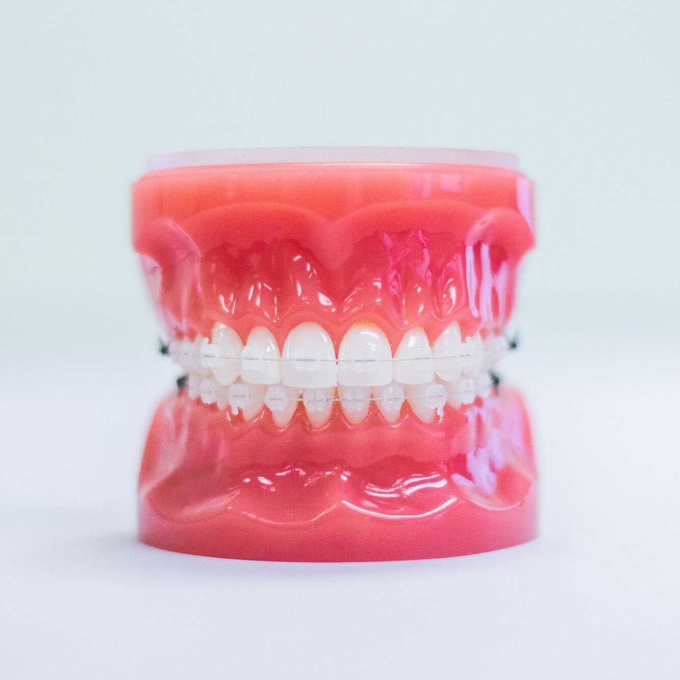 braces wheaton